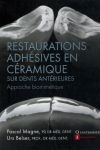 Restaurations adhésives en céramique sur dents antérieures