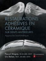 Restaurations adhésives en céramique sur dents antérieures