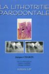 La lithotritie parodontale